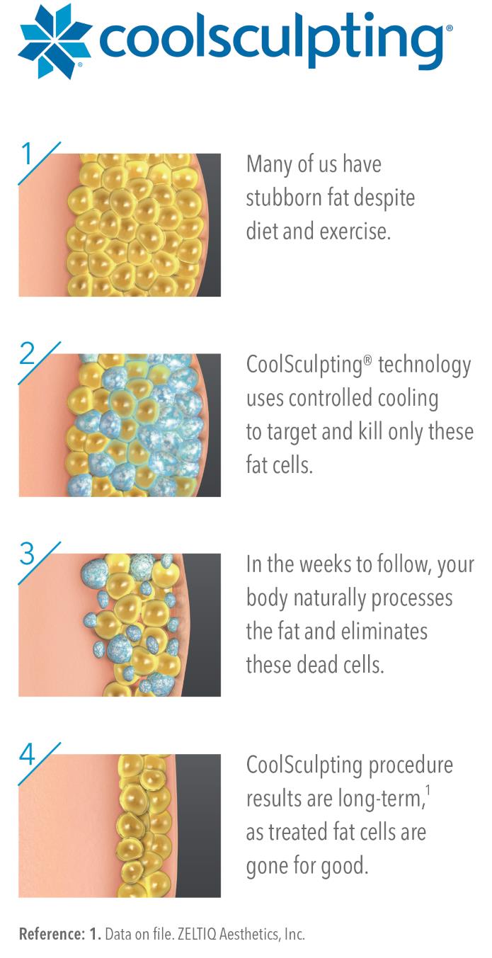 coolsculpting